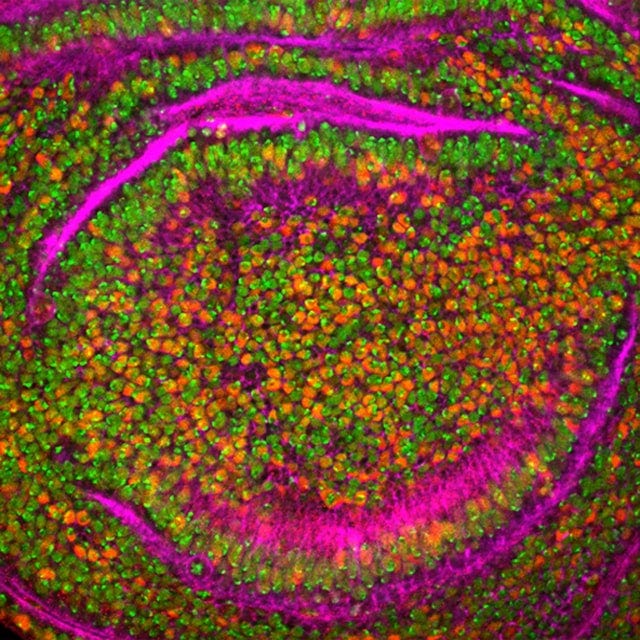 Drosophila wing with stained cell nuclei and actin filaments